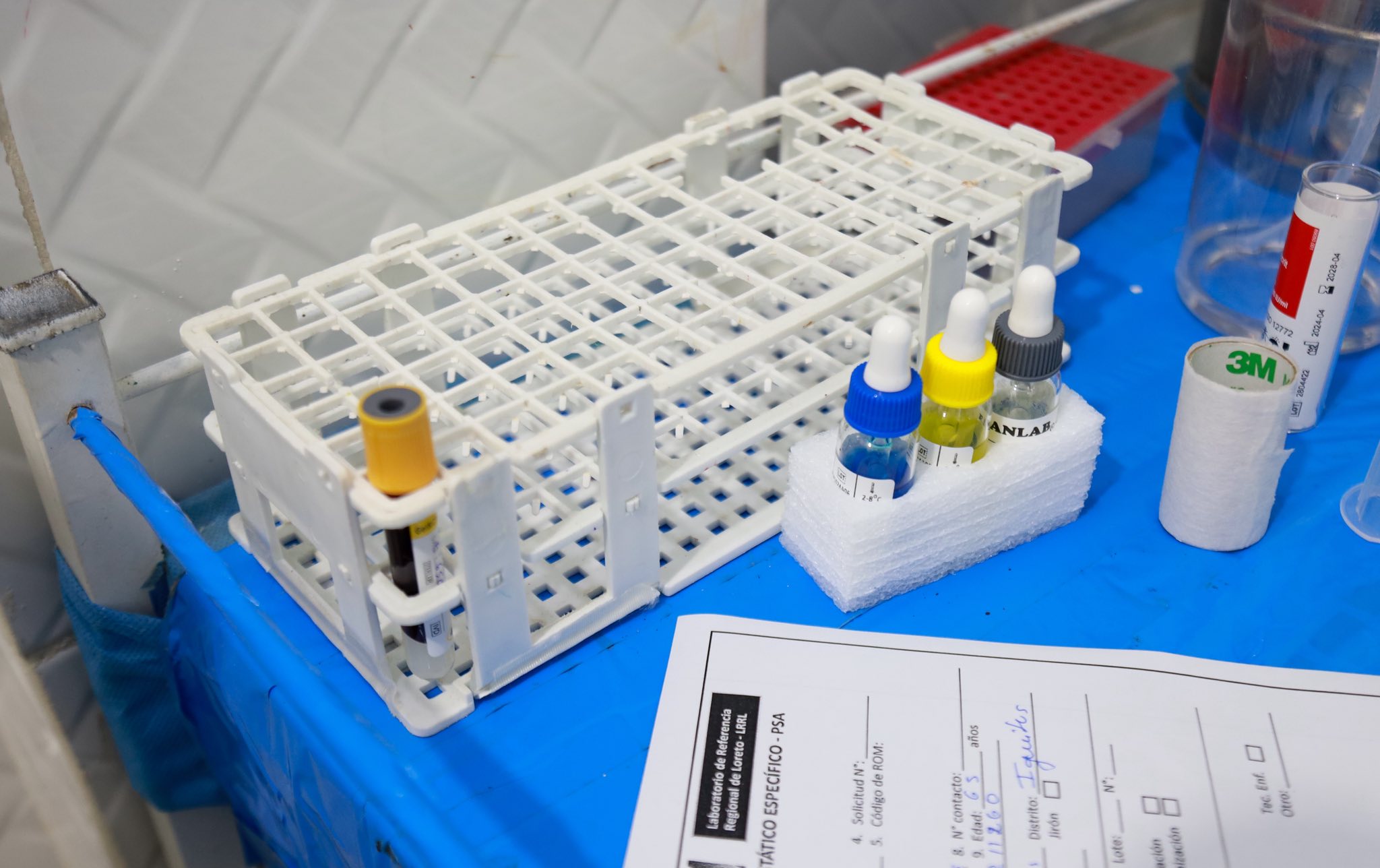 SERVICIO DE LABORATORIO DE LA IPRESS I- 4 MORONACOCHA AL SERVICIO DE LA POBLACIÓN