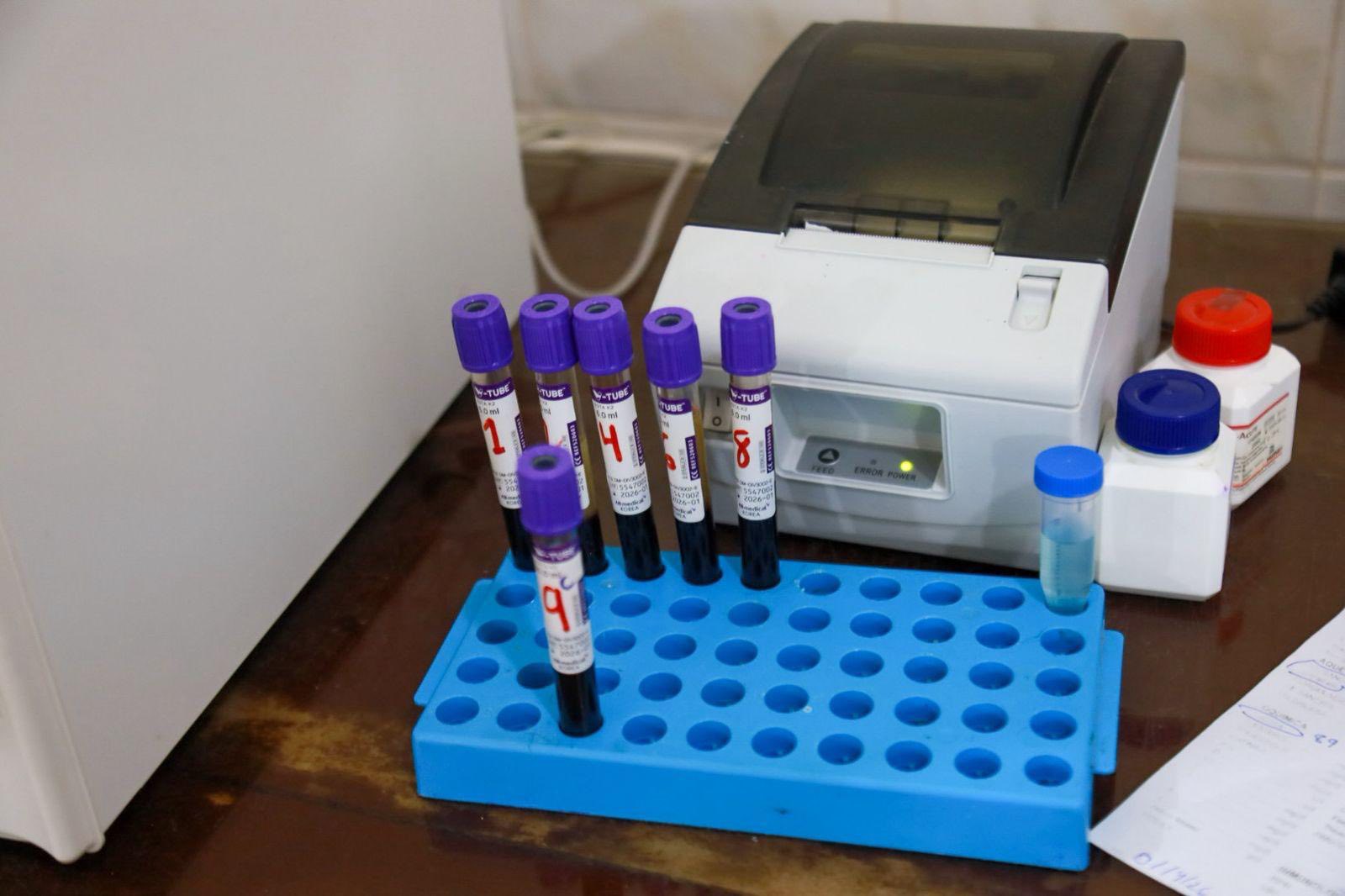 SERVICIOS DE LABORATORIO EN IPRESS GARANTIZAN RESULTADOS CONFIABLES Y OPORTUNOS